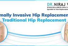 Hshs st nicholas prevea introduce alternative hip replacement surgical table