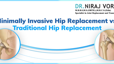 Hshs st nicholas prevea introduce alternative hip replacement surgical table