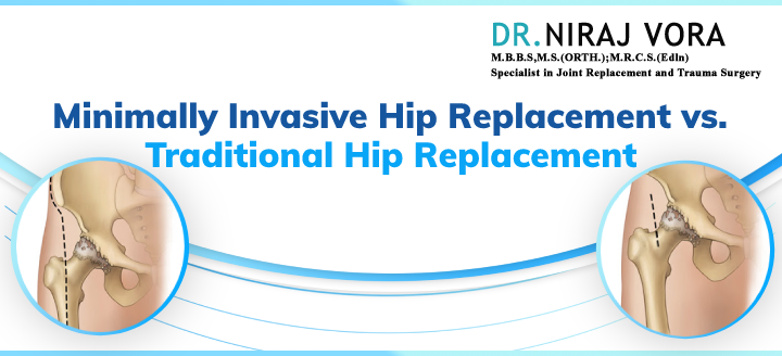 Hshs st nicholas prevea introduce alternative hip replacement surgical table